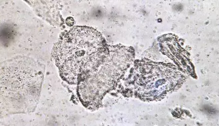 全自动阴道分泌物香蕉福利视频剖析阴道分泌物的洁净度规范