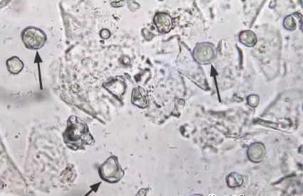 全自动阴道分泌物香蕉福利视频剖析阴道分泌物的洁净度规范