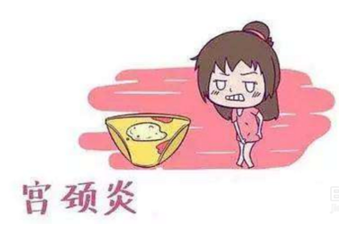 妇科白带香蕉福利视频厂家分析宫颈炎的症状