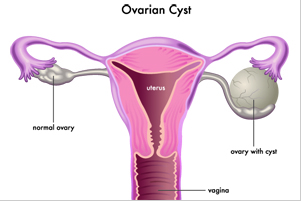 全自动白带香蕉视频免费APP厂家提醒妇科炎症会传染