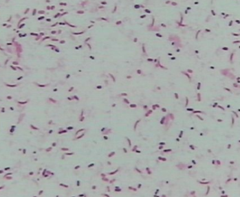 全自动bv检查仪生产厂家讨论bv阳性和男性有关吗？