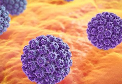 HPV病毒是怎么感染的 HPV病毒是怎么感染的