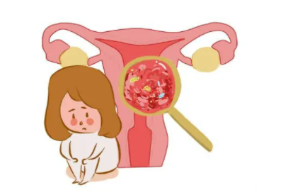 阴道分泌物香蕉福利视频品牌 阴道分泌物香蕉福利视频品牌