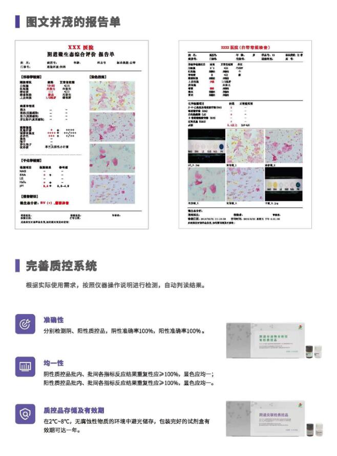 阴道分泌物香蕉视频免费APPV800报告单